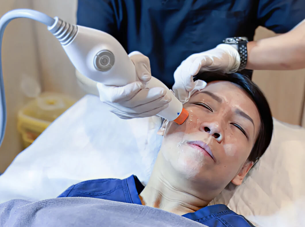 Radiofrequency Skin Tightening