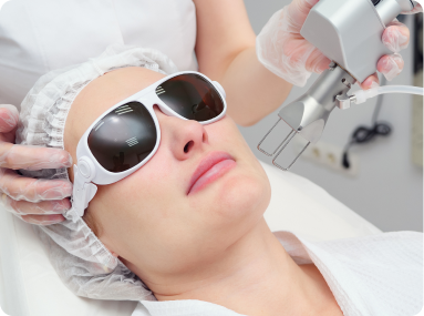 Facial laser treatment