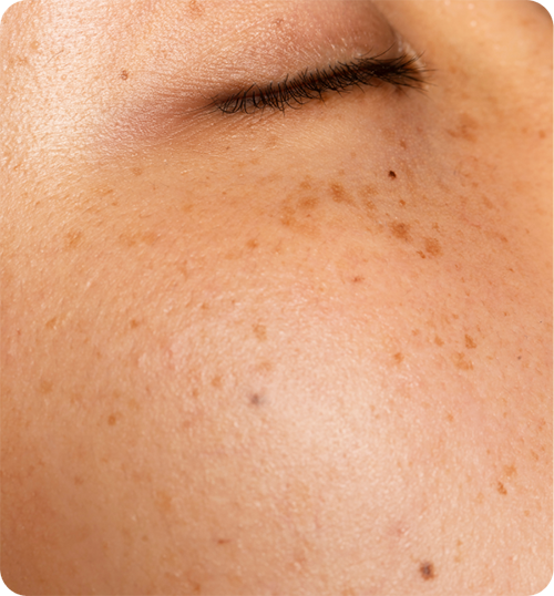 Aesthetic laser clinic singapore